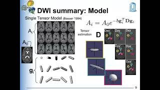 STOR701-002 Lecture3 Diffusion-weighted imaging and diffusion tensor image analysis-I