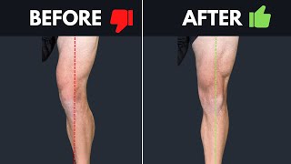 How To Un-F*ck Your Knee - Fixing Inner vs Outer Knee Pain