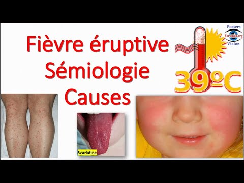 Fièvre éruptive: Sémiologie Éruption erythemato maculo papuleuse  vésiculeuse purpura Toxidermie