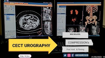 CECT Urography With Delayed, Compression
