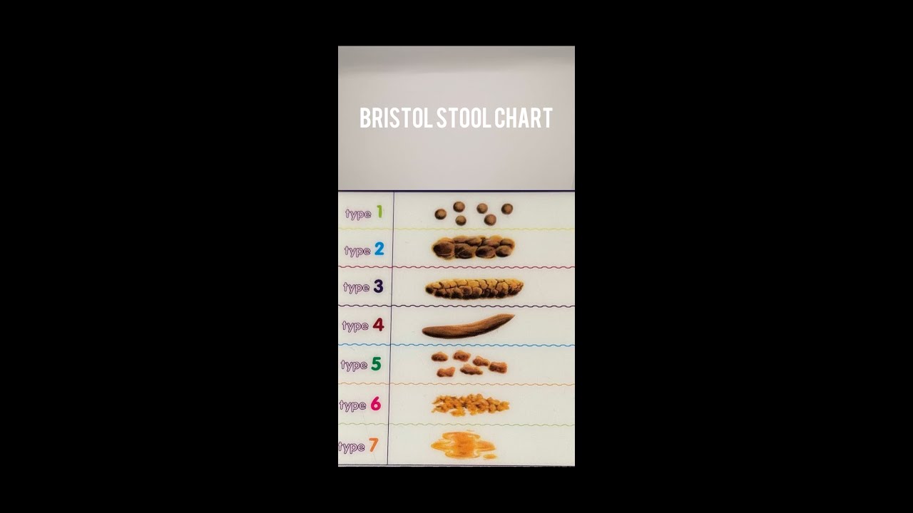 7 Types of Stool With Explanation in Pidgin English YouTube