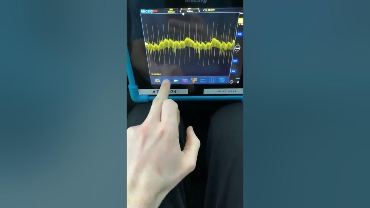How to perform a alternator AC Ripple test using a oscilloscope Peugeot