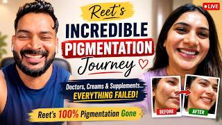 Reet's 100% Pigmentation Gone | Doctors, Creams & Supplements... Everything Failed!