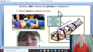 Orthopedic In Arabic 27 Fracture Spine , Part 2 , By Dr. Wahdan