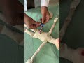 Umblical cord  cutting Procedure #medical #baby #delivery #pregnancy #viralshorts