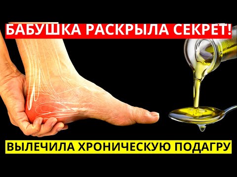 Бабушка Раскрыла Секрет! Как Она Выводит Мочевую Кислоту, Камни, Хроническую Подагру! Крепкий Сон!