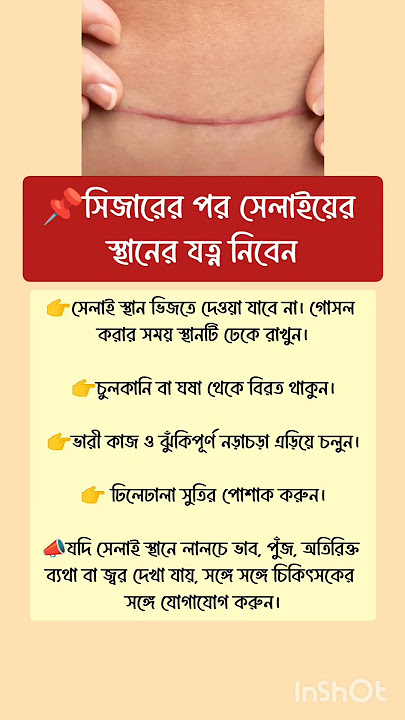 সিজারের পর সেলাইয়ের স্থানের যত্ন নিবেন #সিজার_ডেলিভারি #afterdelivery #afterpregnancy #pregnancy