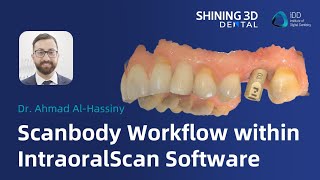 Scan body workflow within IntraoralScan Software