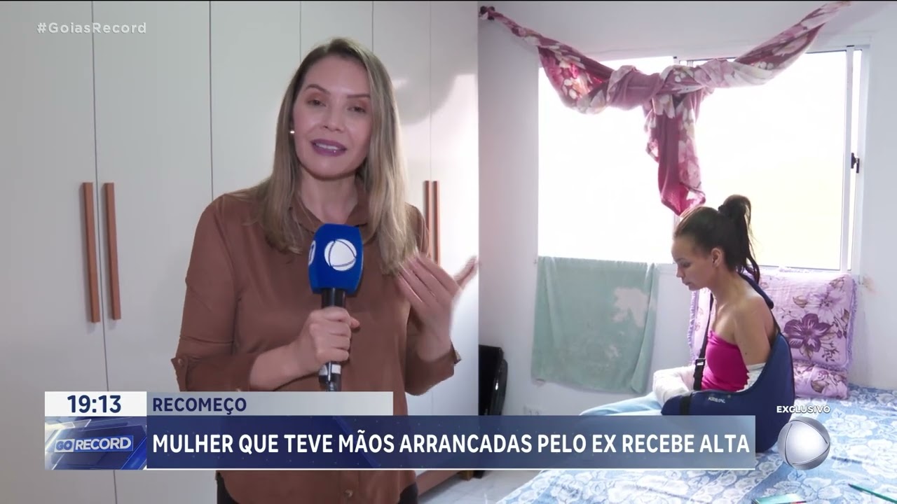 MULHER QUE TEVE MÃOS ARRANCADAS PELO EX RECEBE ALTA