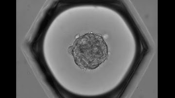 Formation of a spheroid from mesenchymal stem cells (MSCs)