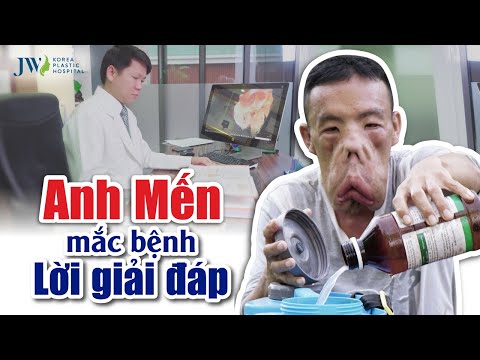Video ANH MẾN MẮC BỆNH - LỜI GIẢI ĐÁP TỪ BÁC SĨ TÚ DUNG - youtube