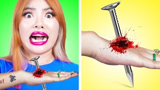 OH NO! I GOT NAIL THROUGH MY HAND | USEFUL DIY LIFE HACKS & AWESOME REMEDIES BY CRAFTY HACKS PLUS