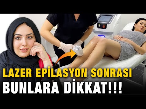 Lazer Epilasyon Sonrası Yapılması Gerekenler! Bunlara Dikkat