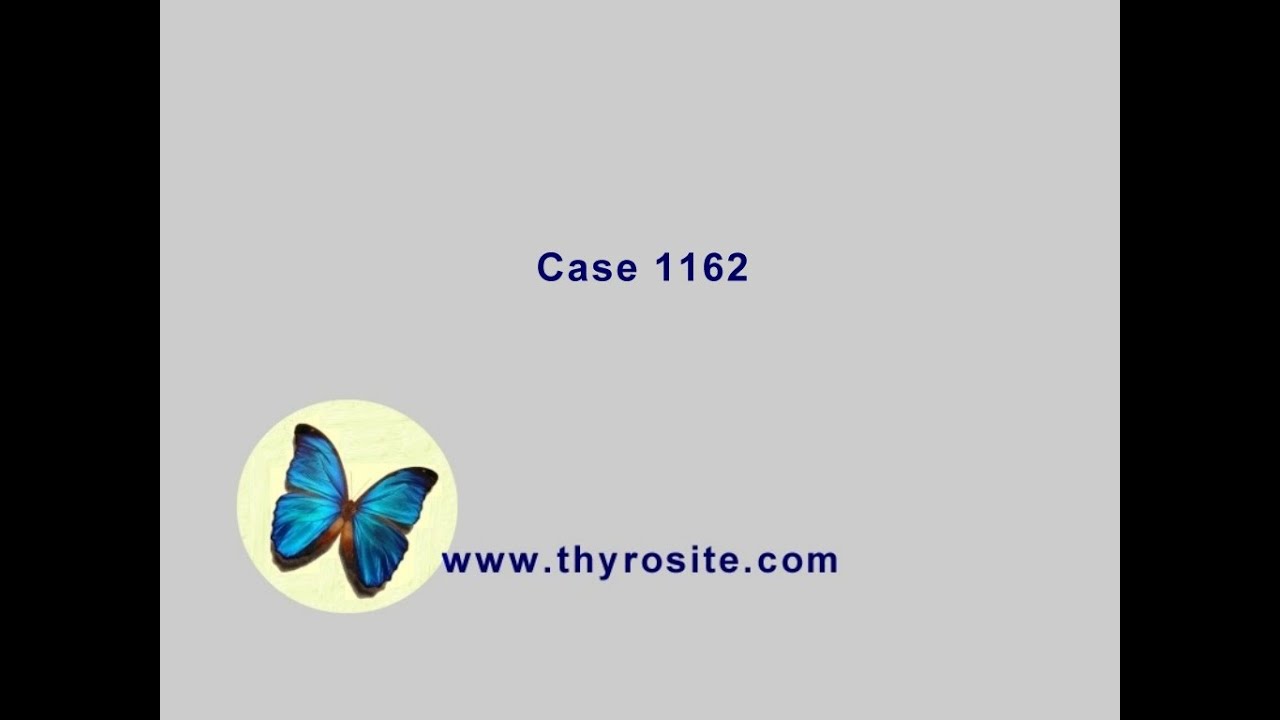 case-1162-youtube