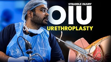 5 minute में Urethral Stricture का ईलाज