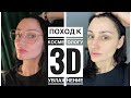 3D увлажнение + ультразвуковая чистка, мезотерапия, причины выпадения волос