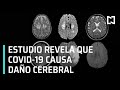 COVID-19 puede causar daños cerebrales serios - Las Noticias