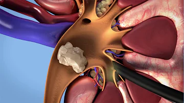 Was ist eine Urinzytologie?