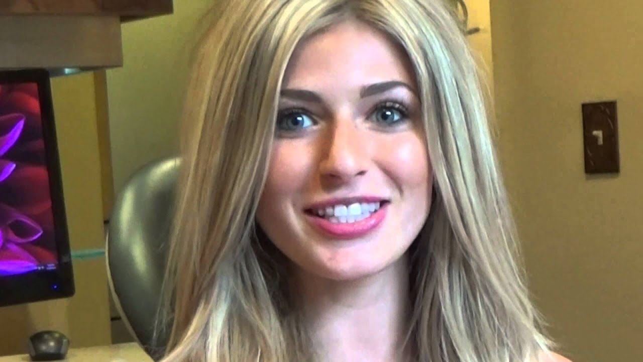 San Diego Invisalign - Is It Worth It?