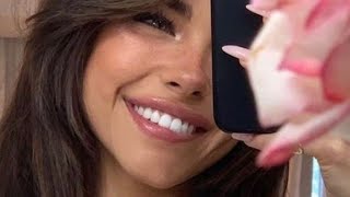 ღ you got rid of gummy smile! ~ gum reduction procedure 💉