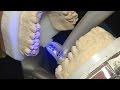 Le dentiste du futur - hi-tech