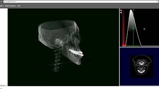3D CT Visualization Web Demo (volume rendering)