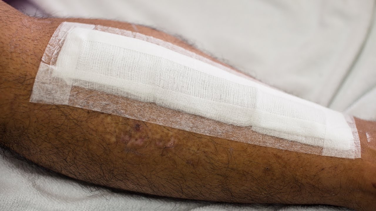 Recorded inar WettoDry Substandard Wound Care YouTube