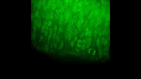 Dividing neural stem cells in a brain