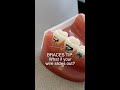 Braces Wire Poking Cheeks or Gums? Here's What to Do... 🦷 #shorts