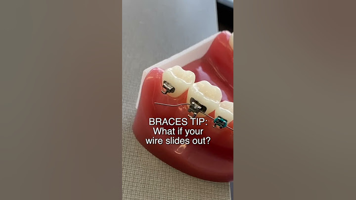 Braces Wire Poking Cheeks or Gums? Here's What to Do... 🦷 #shorts