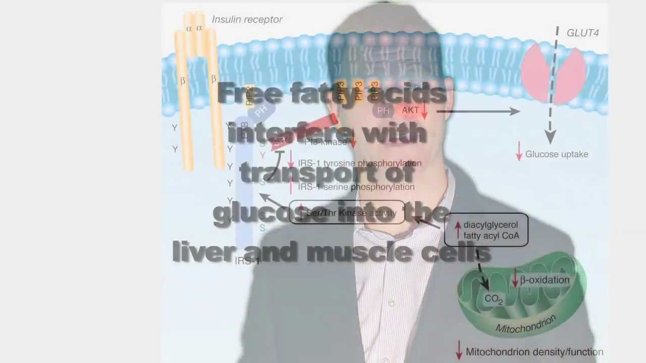 Diabetes treatment talk by Michael Lenz,MD