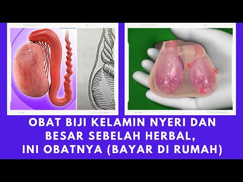 Mengoptimalkan Situs Web untuk Google AdSense: Panduan Lengkap dari Pemilihan Niche hingga Monetisasi