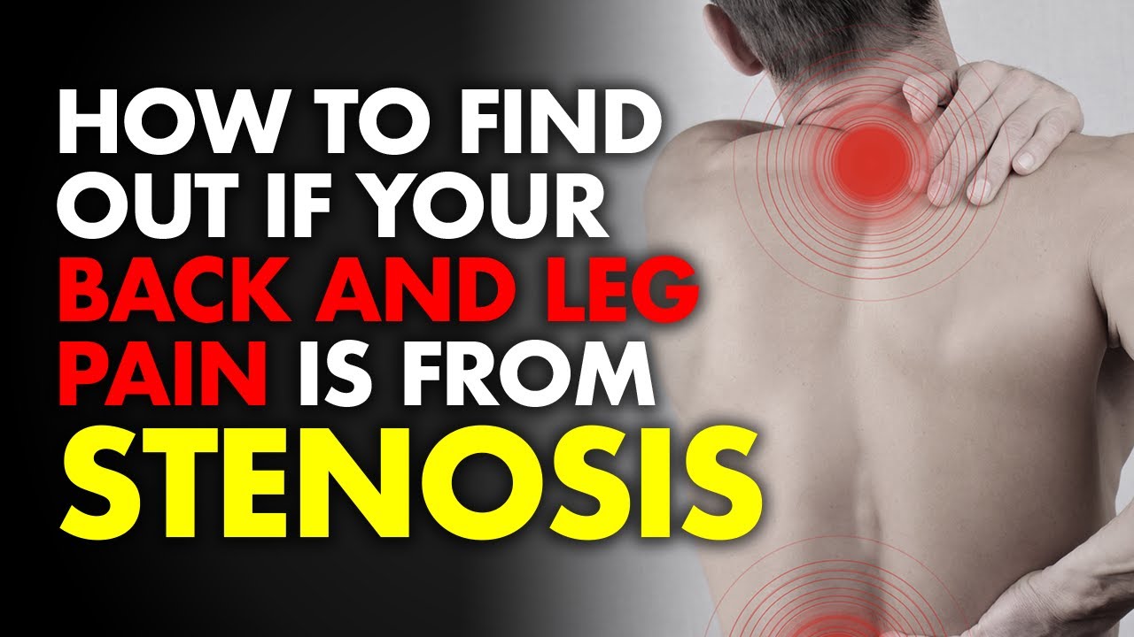 How To Find Out If Your Back And Leg Pain Is From Stenosis YouTube How To Find Out If Your Back And Leg Pain Is From Stenosis YouTube