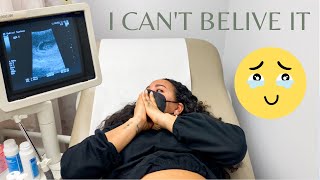 Seeing Our Baby For the First Time Ultrasound | Rainbow Baby | 8 weeks Pregnant