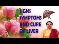 Liver Diseases Signs,Symptoms And Cure By Natural Treatment [Without Medicines]