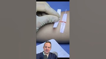 AMAZING WAY TO FIX A CUT WITHOUT STITCHES!😱 #shorts