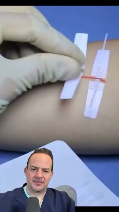 AMAZING WAY TO FIX A CUT WITHOUT STITCHES!😱 #shorts