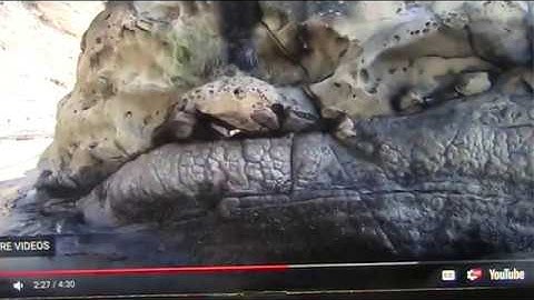 Giant Human Rectum Perfectly Preserved