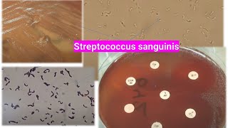 Streptococcus sanguinis colony morphology, Gram staining, wet mount and Antibiogram