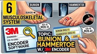 Musculoskeletal system Part 6 | Hammertoe & Bunion | 3M Encoder |Surgery Training Medical coding