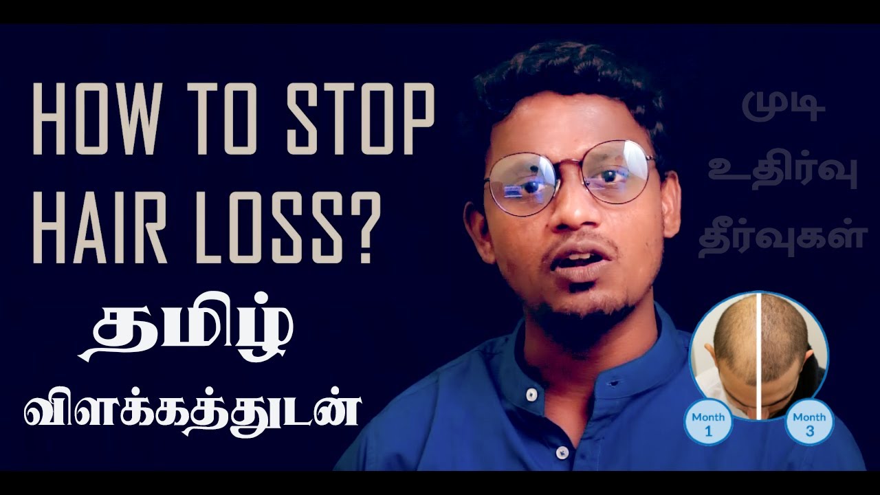 Hair fall control Tamil tips using Minoxidil & Finasteride EASY ways