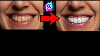 طريقه سهله لتبيض الأسنان باستخدام تطبيق picsart screenshot 5