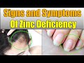 important Signs anThen are eight common signs your zinc situations might be too low