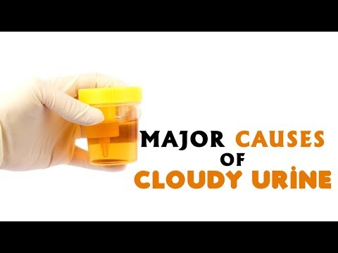 8 Major Causes of Cloudy Urine