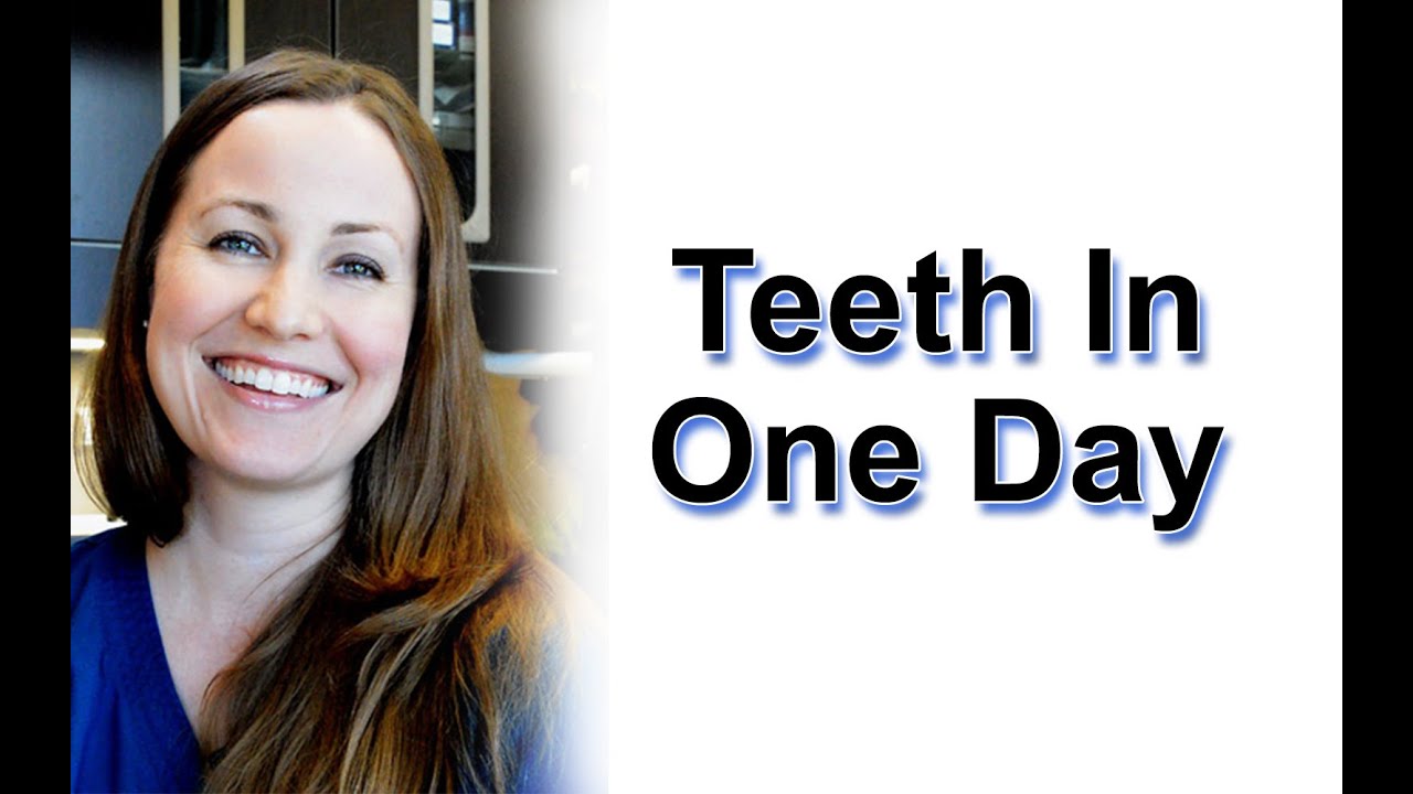 New Teeth In One Day In Conroe TX | (281) 816-4707 | Dr. Holly Gregory DDS