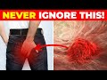 Early Warning Signs of Colon Cancer You Should Never Ignore
