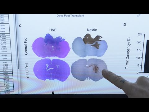 Lower-Carb Diet Slows Growth of Aggressive Brain Tumor