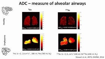 ISMRM MR Academy - Methods and Applications of Hyperpolarized 129Xe