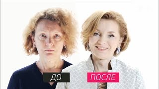 На 10 лет моложе - Как в эстетической стоматологии используют виниры На 10 лет моложе - Как в эстетической стоматологии используют виниры