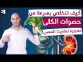 آلام الكلى - كيفية علاج حصوات الكلى؟ الأسباب والأعراض | كل ما عليك فعله لعلاج حصى الكلى فورا